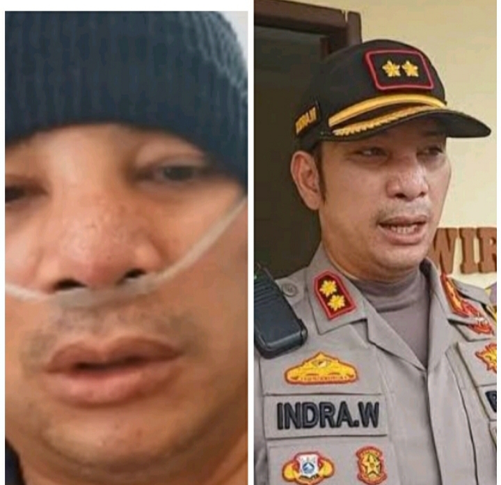 Kapolres Pelalawan Positif Covid-19, Di Rawat di ICU Awal Bros Pekanbaru